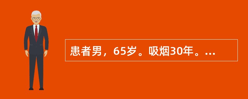 患者男，65岁。吸烟30年。1周来反复发作胸痛，与体力活动有关，休息可以缓解。6小时前出现持续性疼痛，进行性加剧，伴气促，不能平卧。查体：神志清楚，BP90/65mmHg，HR120次／分，律齐，心尖