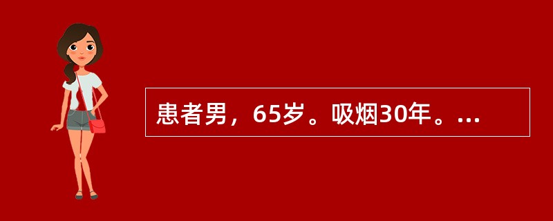 患者男，65岁。吸烟30年。1周来反复发作胸痛，与体力活动有关，休息可以缓解。6小时前出现持续性疼痛，进行性加剧，伴气促，不能平卧。查体：神志清楚，BP90/65mmHg，HR120次／分，律齐，心尖