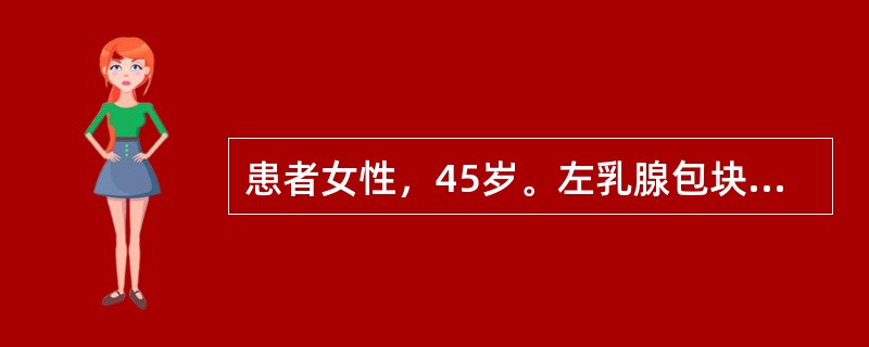 患者女性，45岁。左乳腺包块2年，镜检如图所示乳腺小叶导管和腺泡上皮细胞的增生、导管囊状扩张，层次增多，轻度异型，局部呈筛状结构，间质纤维组织增生。则该病变的诊断是()<img border=&