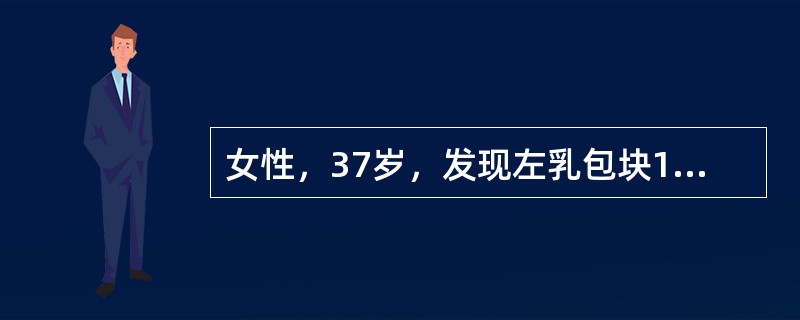 女性，37岁，发现左乳包块1月余。无疼痛不适，无粘连增大，与月经有关。手术切除包块送检。下列哪项不是该病镜下特征()