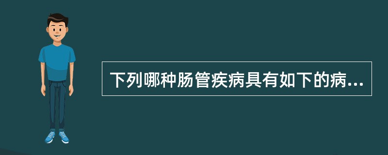 下列哪种肠管疾病具有如下的病变：溃疡边缘不整，其长轴与肠轴垂直，溃疡底部附有干酪样坏死物