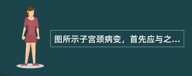 图所示子宫颈病变，首先应与之鉴别的病变是　　<img border="0" style="width: 184px; height: 126px;" sr