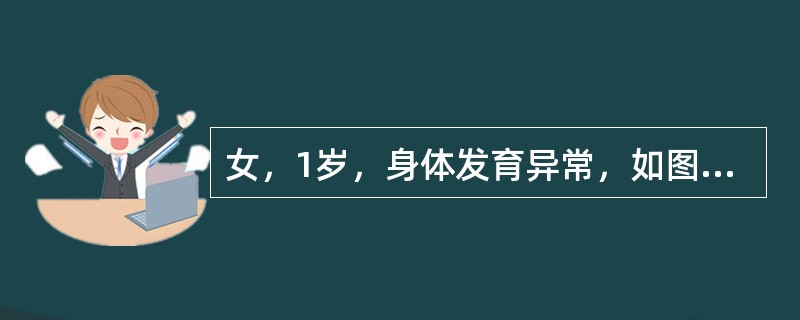 女，1岁，身体发育异常，如图所示，最可能的诊断为<img border="0" style="width: 260px; height: 100px;"