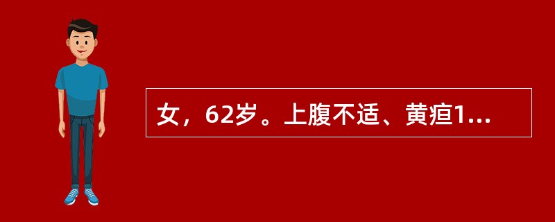 女，62岁。上腹不适、黄疸1个月，CT检查如图。<br /><img src="https://img.zhaotiba.com/fujian/20220728/d1wuq