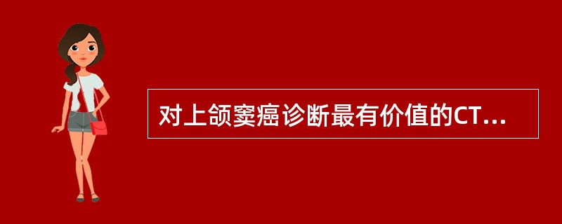 对上颌窦癌诊断最有价值的CT征象为