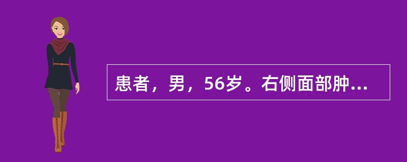 患者，男，56岁。右侧面部肿胀、麻木2个月余，伴流涕。CT示右侧上颌窦内软组织密度影，后外侧壁骨质消失。诊断为