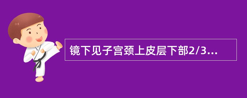 镜下见子宫颈上皮层下部2/3的细胞出现异型性增生，但未达到全层，诊断为