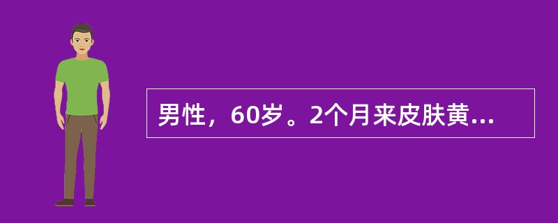 男性，60岁。2个月来皮肤黄染进行性加深伴皮肤瘙痒住院。体检：巩膜深度黄染，肝肋下3cm，质偏硬，有压痛，脾未及。化验：总胆红素346umol／L，结合胆红素180umol／L，凝血酶原时间18秒（对