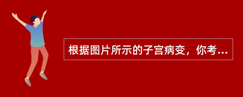 根据图片所示的子宫病变，你考虑最可能的病理诊断是<img border="0" style="width: 164px; height: 126px;"