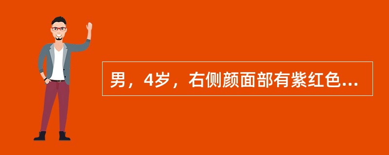 男，4岁，右侧颜面部有紫红色瘤，智力障碍，MRI检查如图，最可能的诊断是()<img border="0" style="width: 356px; height: