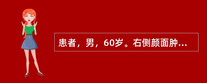 患者，男，60岁。右侧颜面肿胀，右眼球渐突出5个月。CT显示右上颌窦腔增大，窦壁变薄伴局部骨质消失，窦腔内见软组织密度，含气消失。最大可能是