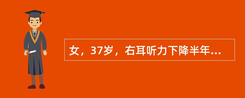 女，37岁，右耳听力下降半年，走路不稳2周，MRI检查如图，最可能的诊断为()<img border="0" style="width: 208px; height