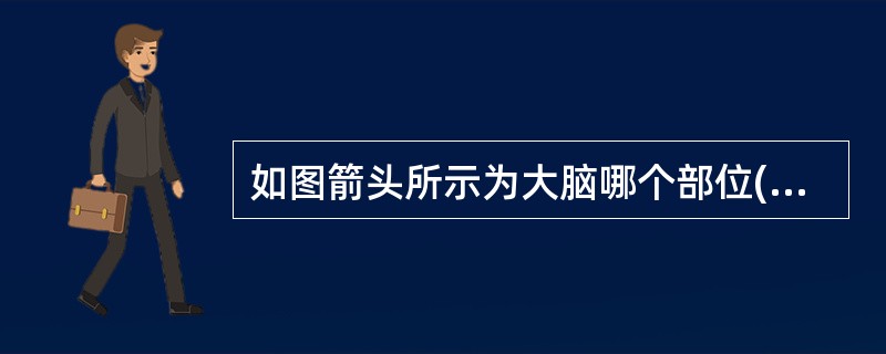 如图箭头所示为大脑哪个部位()<img border="0" style="width: 299px; height: 224px;" src="