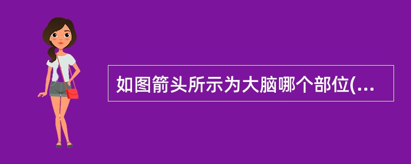如图箭头所示为大脑哪个部位()<img border="0" style="width: 426px; height: 320px;" src="