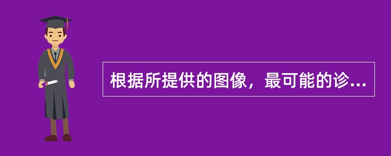 根据所提供的图像，最可能的诊断是<img border="0" style="width: 301px; height: 225px;" src=&quo