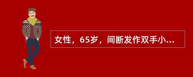 女性，65岁，间断发作双手小关节疼痛2年，无肿胀，伴晨僵约20分钟，其余关节未受累，血尿常规正常，血沉正常，RF(-)。患者最可能出现的体征是