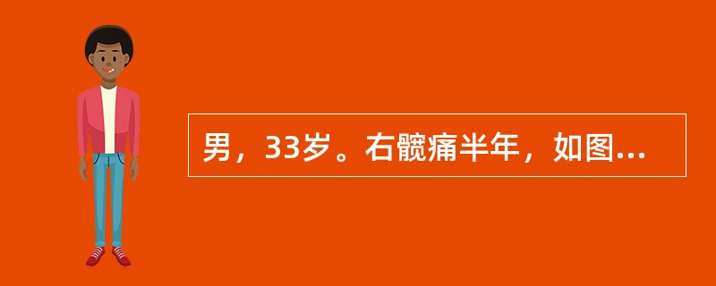 男，33岁。右髋痛半年，如图，最可能的诊断为<img border="0" style="width: 145px; height: 213px;" sr