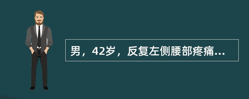 男，42岁，反复左侧腰部疼痛伴血尿3个月余，CT检查如图，下列说法错误的是<img border="0" style="width: 293px; height: