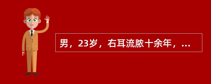 男，23岁，右耳流脓十余年，右外耳道流脓，鼓膜穿孔，CT检查如图，最可能的诊断是<img border="0" style="width: 297px; heigh