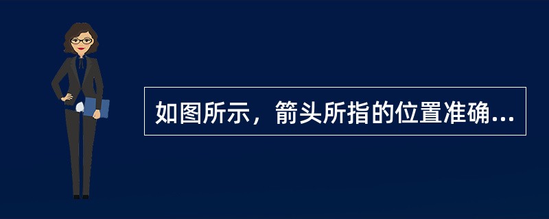 如图所示，箭头所指的位置准确的解剖描述是<img border="0" style="width: 305px; height: 158px;" src=