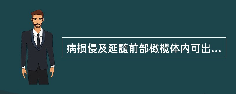 病损侵及延髓前部橄榄体内可出现病灶侧周围性舌下神经瘫及对侧偏瘫，此为