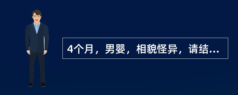 4个月，男婴，相貌怪异，请结合图片选出最可能的诊断()<img border="0" style="width: 370px; height: 264px;&quo