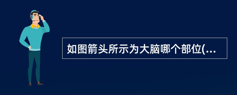 如图箭头所示为大脑哪个部位()<img border="0" style="width: 299px; height: 224px;" src="