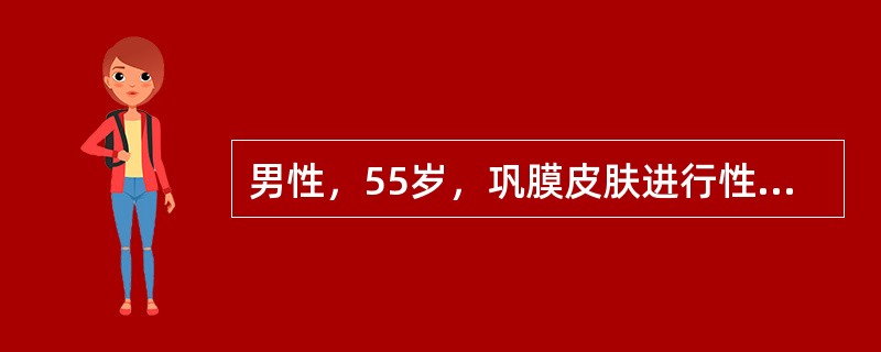 男性，55岁，巩膜皮肤进行性黄染2月余，伴皮肤瘙痒，腹部检查发现胆囊明显肿大，呈圆形光滑可推动，且无压痛，首先应考虑下列哪一种疾病