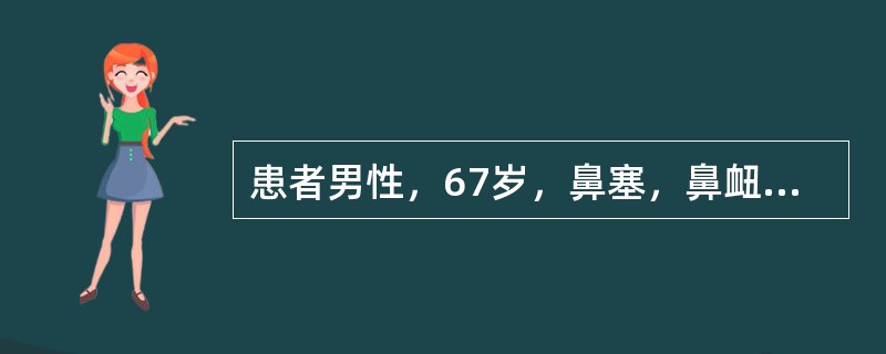 患者男性，67岁，鼻塞，鼻衄8个月，鼻腔镜见鼻咽顶部黏膜粗糙，触之易出血。病理活检镜下观如图：肿瘤细胞弥漫性增生，瘤细胞形态单一，胞浆少，核形不规则，染色质粗而致密，核分裂像易见。免疫组化肿瘤细胞表达