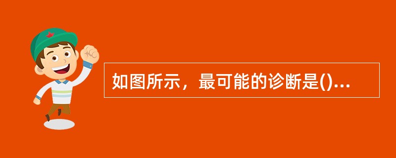 如图所示，最可能的诊断是()<img border="0" style="width: 242px; height: 182px;" src="