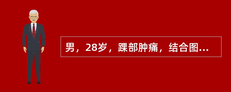男，28岁，踝部肿痛，结合图像，最可能的诊断是()<img border="0" style="width: 360px; height: 270px;"