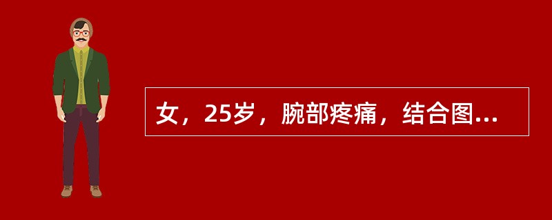 女，25岁，腕部疼痛，结合图像，最可能的诊断是()<img border="0" style="width: 214px; height: 160px;"