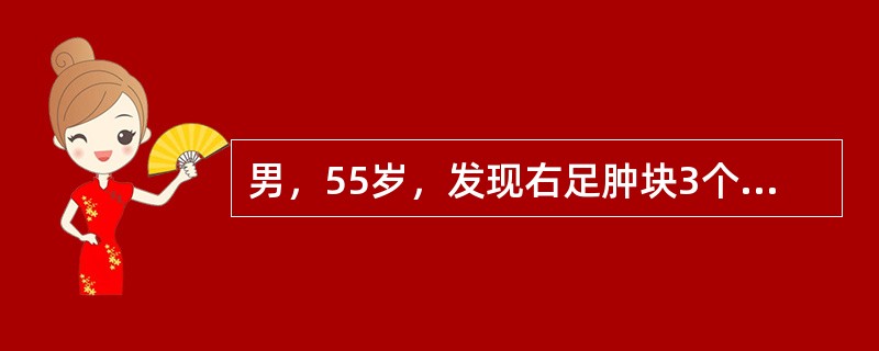 男，55岁，发现右足肿块3个月余，结合图像，最可能的诊断是()<img border="0" style="width: 194px; height: 145px;