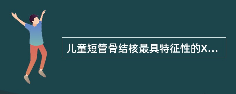 儿童短管骨结核最具特征性的X线表现是()