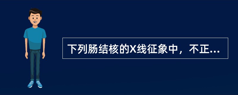 下列肠结核的X线征象中，不正确的是