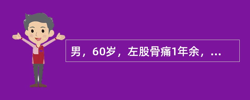 男，60岁，左股骨痛1年余，结合图像，最可能的诊断是()<img border="0" style="width: 335px; height: 251px;&qu
