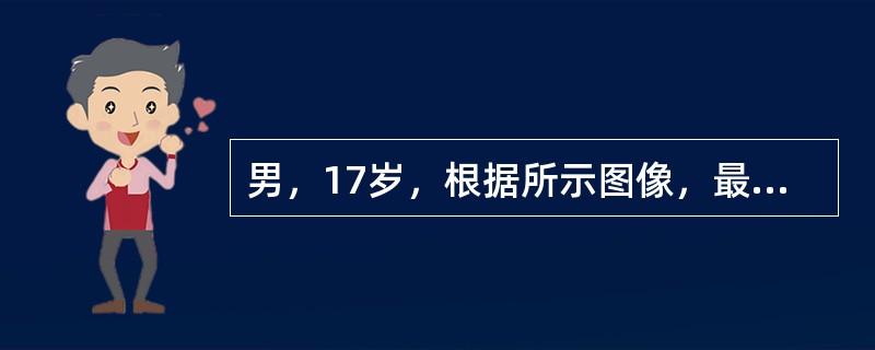 男，17岁，根据所示图像，最可能的诊断是()<img border="0" style="width: 171px; height: 128px;" sr