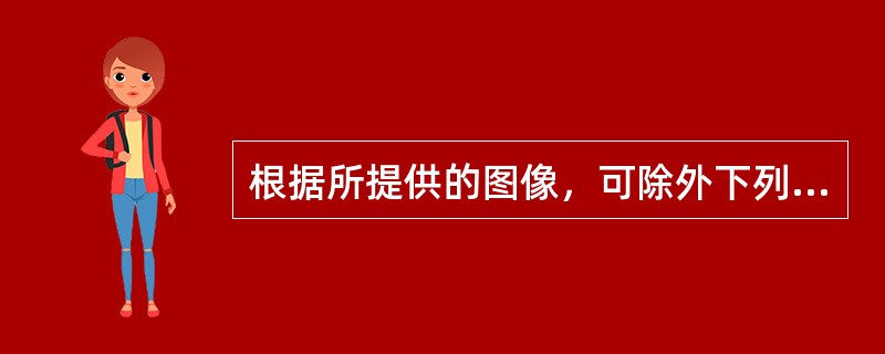 根据所提供的图像，可除外下列哪种诊断()<img border="0" style="width: 350px; height: 263px;" src=