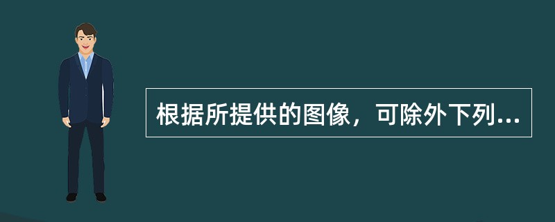 根据所提供的图像，可除外下列哪种诊断()<img border="0" style="width: 262px; height: 197px;" src=