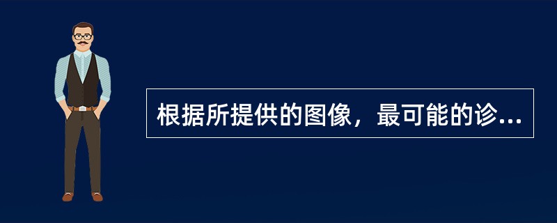 根据所提供的图像，最可能的诊断是()<img border="0" style="width: 218px; height: 163px;" src=&q