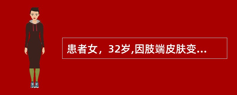 患者女，32岁,因肢端皮肤变硬，面具脸6个月入院，患者平素接触冷水后双手变白、变紫。最可能的诊断是