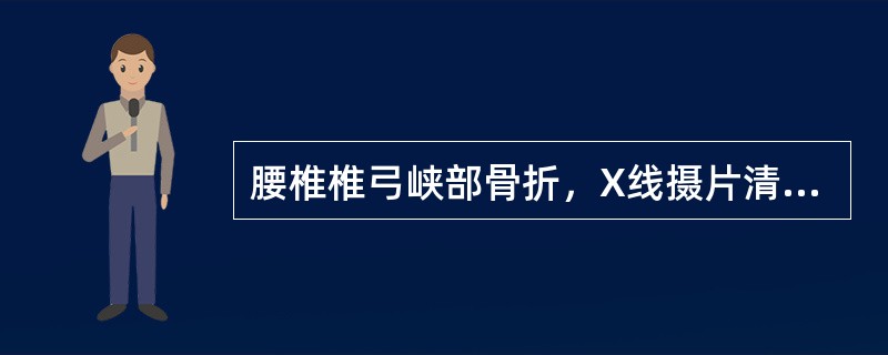 腰椎椎弓峡部骨折，X线摄片清晰显影于