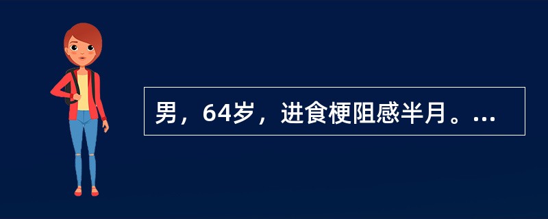 男，64岁，进食梗阻感半月。体检：咽充血少许滤泡，结合图像，最可能的诊断为()<img border="0" style="width: 358px; height
