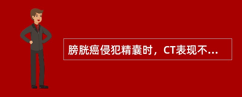 膀胱癌侵犯精囊时，CT表现不正确的是