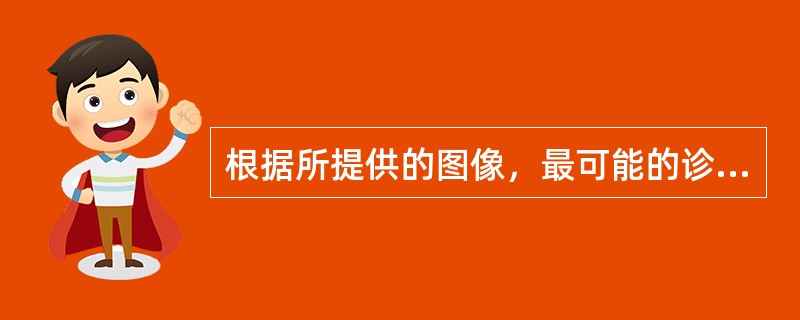 根据所提供的图像，最可能的诊断是()<img border="0" style="width: 210px; height: 158px;" src=&q