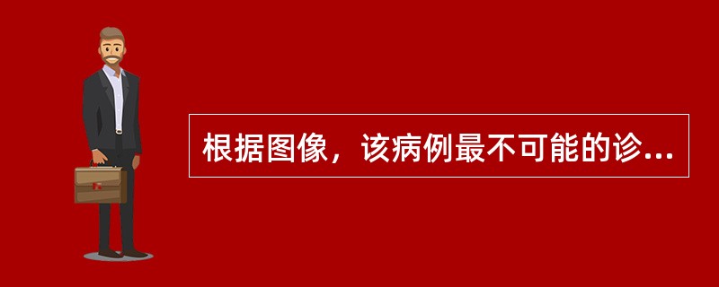 根据图像，该病例最不可能的诊断为()<img border="0" style="width: 210px; height: 157px;" src=&q
