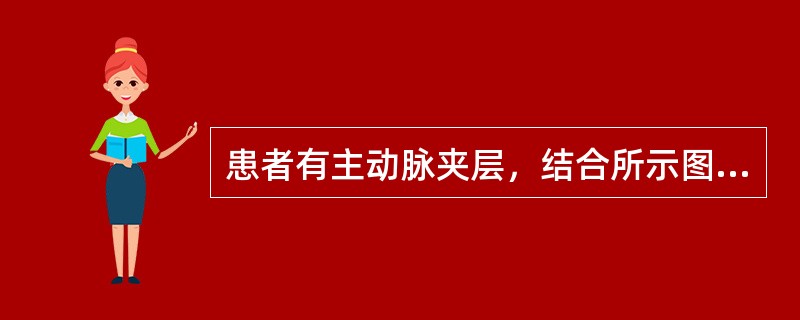 患者有主动脉夹层，结合所示图像所示，下列哪项陈述是正确的()<img border="0" style="width: 192px; height: 144px;&