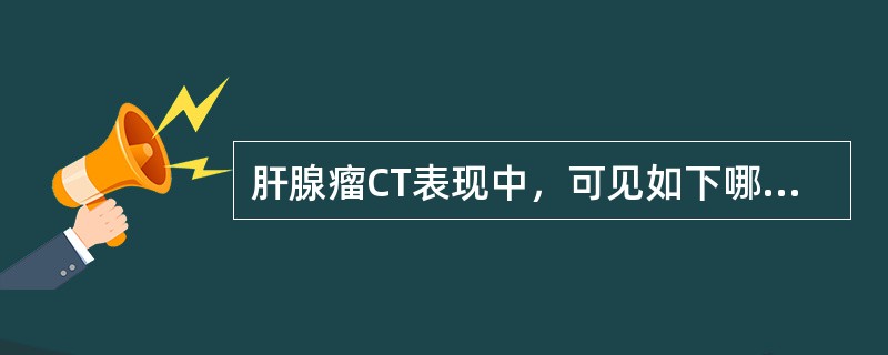 肝腺瘤CT表现中，可见如下哪些征象()