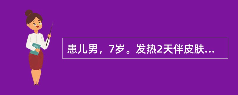 患儿男，7岁。发热2天伴皮肤紫癜。查体：T39.1℃，肝肋下2.5cm、脾肋下4cm，颈部淋巴结可触及。提示：血常规检查：Hb78g／L，WBC34.2×10<img border="