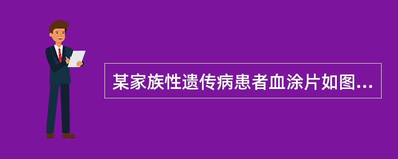 某家族性遗传病患者血涂片如图，红细胞渗透脆性增加，下述哪项不符合其病情。()<img border="0" style="width: 379px; height: